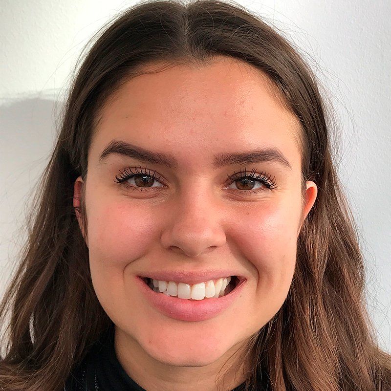 Smil før Invisalign