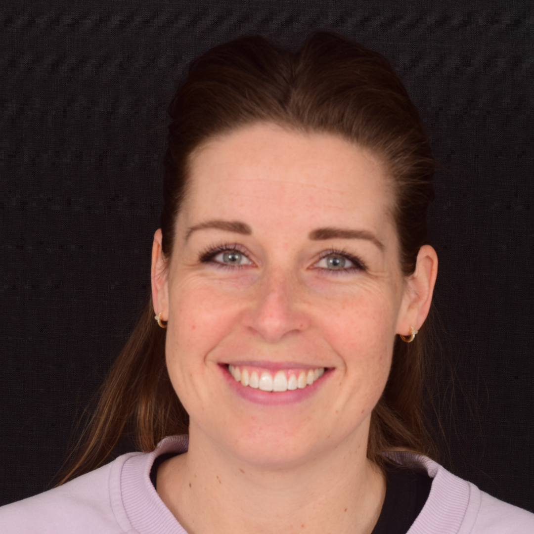 Maria efter Invisalign