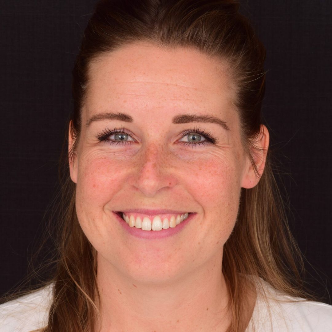Marie inden Invisalign