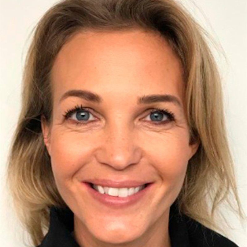 Tina Lund før Invisalign