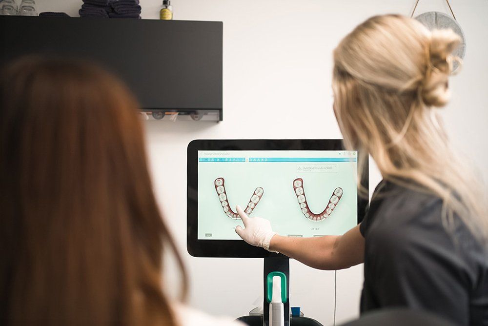 Korrektion af tandstillingsfejl med Invisalign